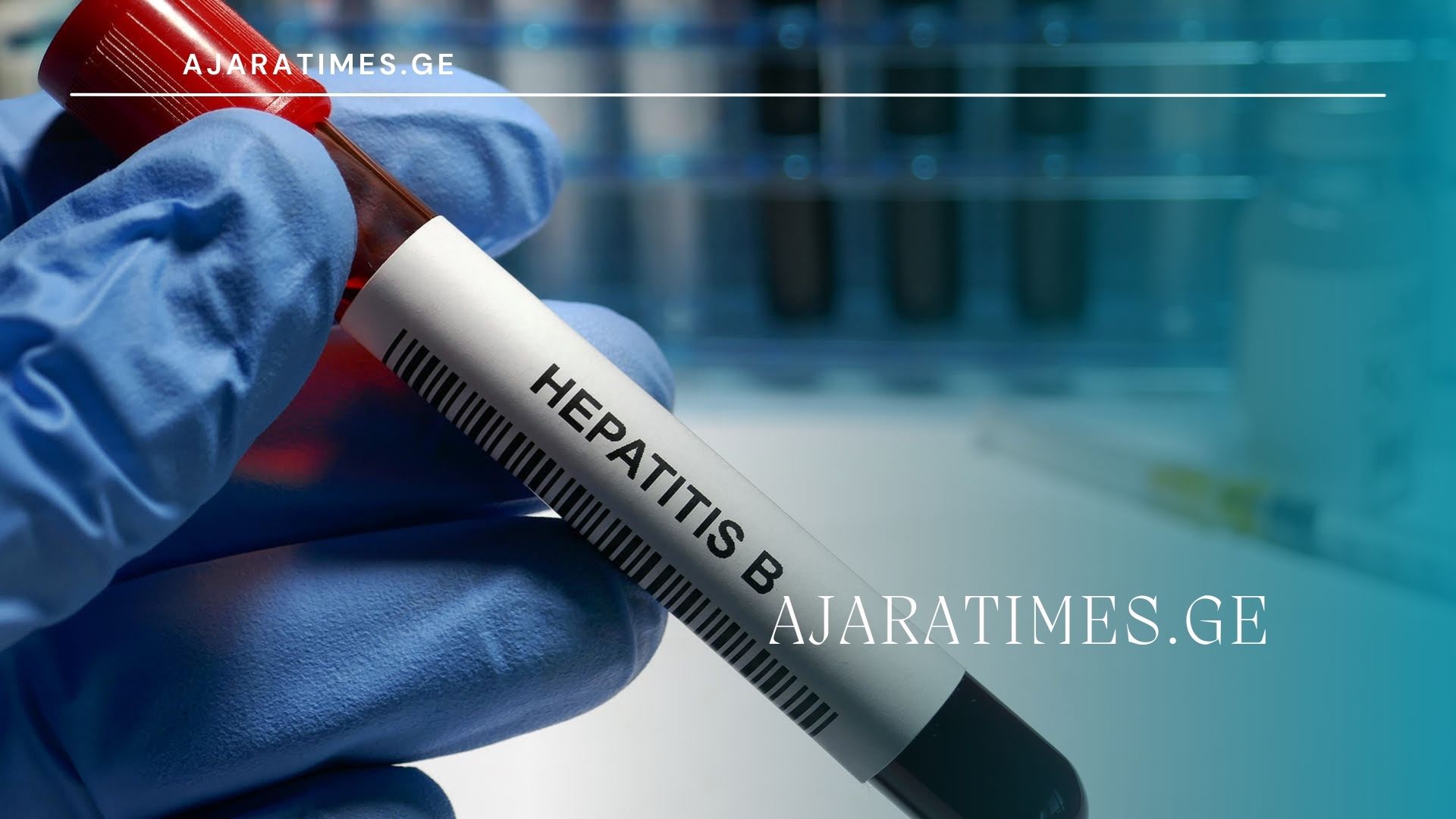 b hepatiti_AJARATIMES.GE